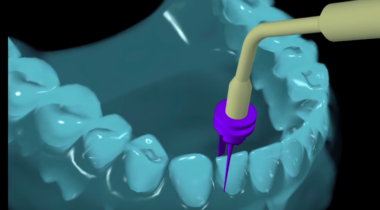 advanced dental hygiene