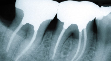 Adv-Contemp-Endo